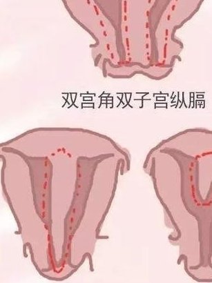 有类风湿关节炎的患者适合做试管婴儿吗？