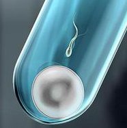 泰国做试管要多少钱？试管婴儿的步骤是什么？