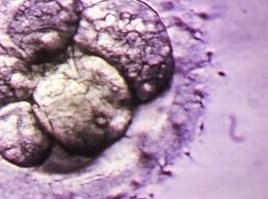 在三明做第三代试管婴儿哪家医院最便宜？影响三代试管费用的因素有哪些？